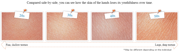 Compared side-by-side, you can see how the skin of the hands loses its youthfulness over time